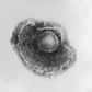 Le virus varicelle-zona, visible ici au microscope électronique à transmission, provoque l'apparition de vésicules sur l'ensemble du corps. © DR
