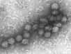 Le virus du Nil occidental est un virus sphérique, responsable de violentes fièvres chez l'Homme. © DR