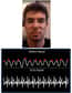 Un groupe de chercheurs du Massachusetts Institute of Technology a développé un algorithme capable de mesurer le pouls d’une personne à partir de l’analyse des mouvements de sa tête capturés en vidéo. Une technologie qui pourrait s’avérer très utile pour suivre à distance des personnes âgées, ou bien des nouveau-nés prématurés sur lesquels la pose d’électrodes peut s’avérer délicate. Le professeur Frédo Durand, membre de l’équipe du MIT, a répondu aux questions de Futura-Sciences.