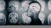 L'analyse des IRM cérébrales a permis aux chercheurs d'une nouvelle étude d'identifier une « signature » de la démence. © Tryfonov, Adobe Stock