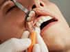 L’association entre l’hygiène bucco-dentaire et la santé du cerveau est de nouveau mise en avant dans le cadre d’une étude japonaise. Les maladies des gencives ainsi que le nombre de dents pourraient révéler un déclin cognitif, mais pas forcément dans le sens attendu.