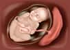 Le placenta permet les échanges entre la mère et l’enfant pendant la grossesse. Qu’est-ce qu’un placenta praevia ? Quels sont les symptômes et les risques pour la mère et pour l’enfant ? Un accouchement par voie basse reste-t-il possible ?