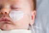 La bronchiolite du nourrisson est une affection virale des voies respiratoires basses, bénigne, contagieuse chez les bébés et les enfants en bas âge mais qu'il faut cependant surveiller attentivement car, si la plupart du temps, la maladie évolue spontanément vers la guérison en une dizaine de jours, elle peut parfois se compliquer par une détresse respiratoire.