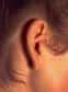 Une rupture du tympan, comme un coup de tonnerre, peut survenir soudainement. Vous pouvez ressentir une douleur aiguë dans l'oreille, ou un mal d'oreille que vous avez eu pendant un certain temps disparaît soudainement. Il est également possible que vous n'ayez aucun signe de rupture de votre tympan.
