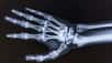 Le métacarpe forme le squelette de la paume de la main, situé entre les os du poignet (le carpe) et les os des doigts (les phalanges). Il est constitué de ces cinq os longs, les métacarpiens, chacun étant relié aux os de l’un des cinq doigts de la main. © Raymond Orton, Adobe Stock
