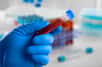 Les tests sanguins montrent leur preuve dans la détection précoce du cancer. © BillionPhotos.com, Adobe Stock