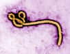 La molécule NPC1, qui permet l'entrée du virus Ebola dans le cytoplasme de la cellule, est essentielle à l’infection. Comme le montrent des études chez la souris, il s’agirait du « talon d’Achille » du virus : si NPC1 est défaillante, les souris échappent à la maladie.