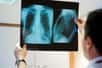 Une radiographie montre les poumons à l'intérieur du thorax © Chlorophylle, Adobe Stock