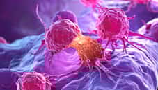 Les métastases : quand le cancer s’étend et change la donne. © Sam Adobe Stock