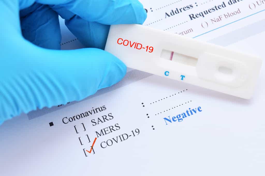 Que vaut la fiabilité des tests du SARS-Cov-2 ? © jarun011, Adobe Stock