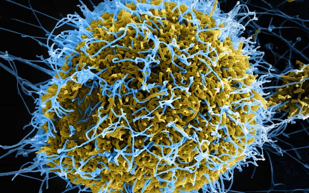 Virus d'Ebola, qui appartient à la même famille que le virus de Marburg (filovirus). © DR