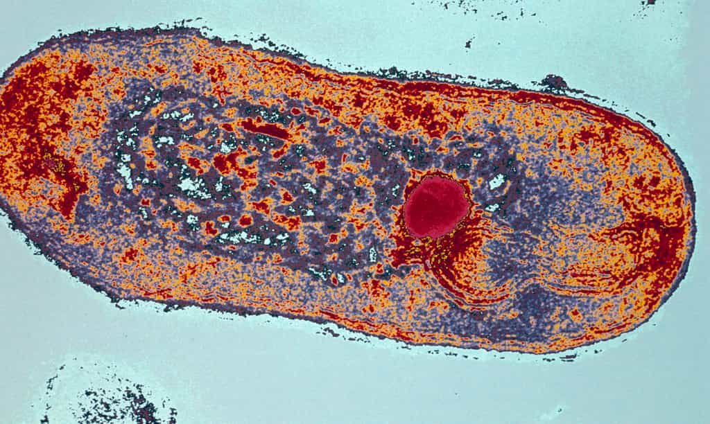 Tuberculose, scorbut, rougeole, polio : ces anciennes maladies refont surface dans les pays riches. © Institut Pasteur, Antoinette Ryter