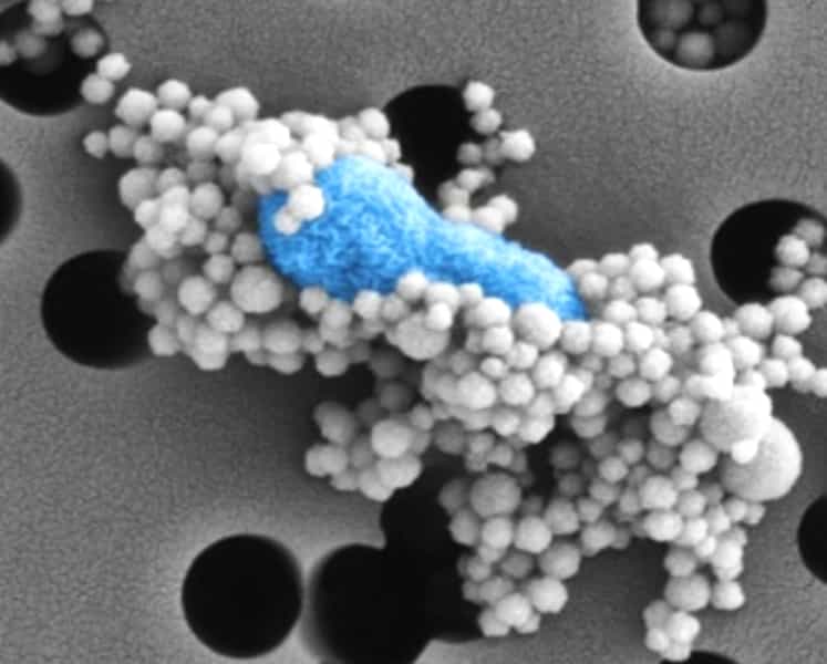 Des nanobilles magnétiques recouvertes de protéine MBL se fixent à une bactérie (colorée en&nbsp;bleu) de type Escherichia coli sur cette image prise au microscope électronique. On peut se servir de ce phénomène pour faire une sorte de dialyse qui va collecter magnétiquement les nanobilles et ainsi retirer du sang&nbsp;une grande partie des bactéries auxquelles elles sont collées. © Harvard's Wyss Institute