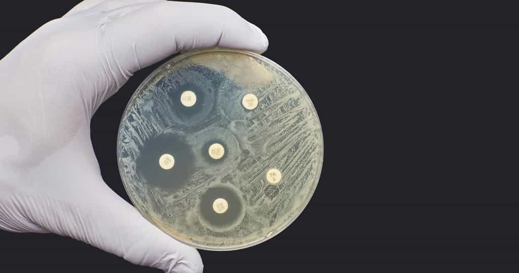 Shigella sonnei est une souche résistante aux antibiotiques. Un antibiogramme permet de savoir quel est l'antibiotique le plus efficace. © Nicolae, Adobe stock