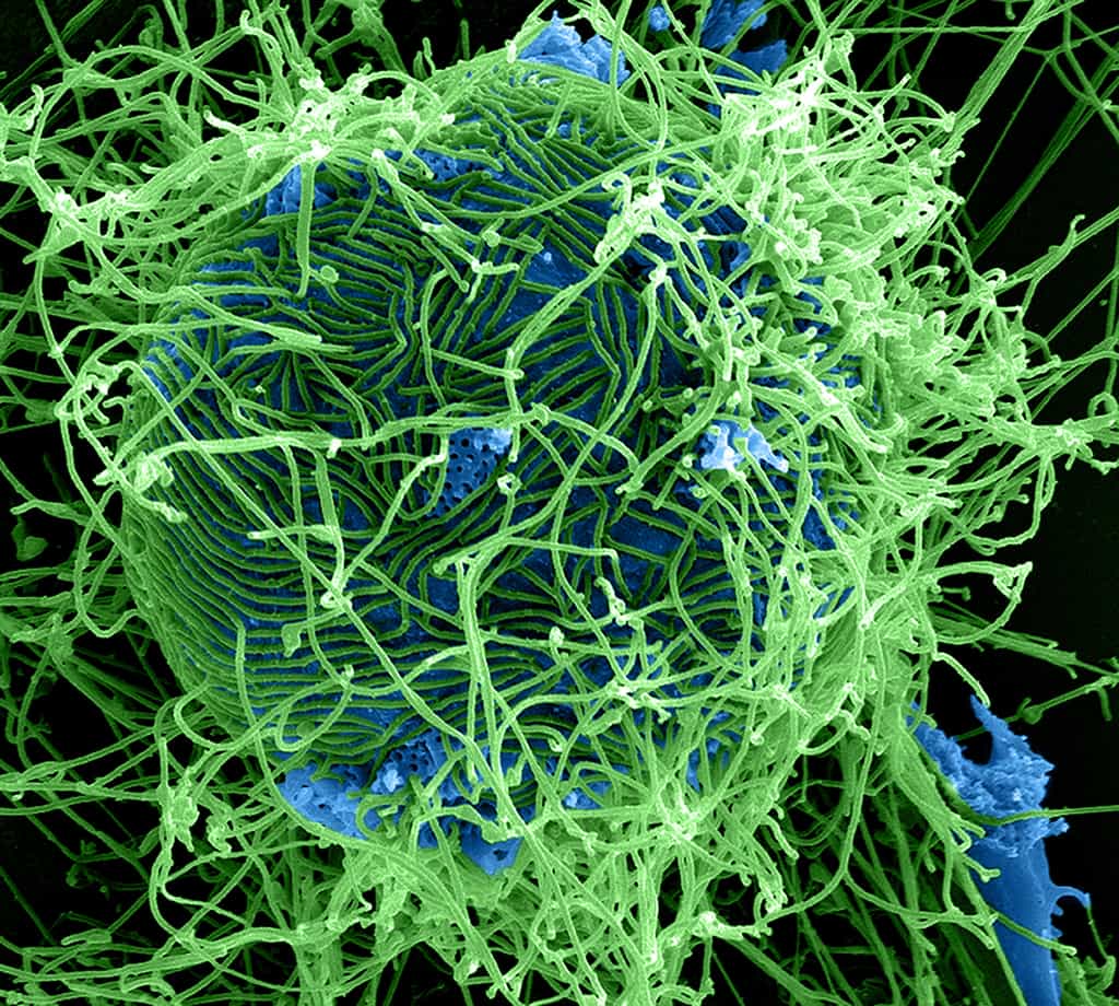 Le virus Ebola (en vert) infectant des cellules (zoom ×25.000). © NIAID, Flickr, CC By-2.0