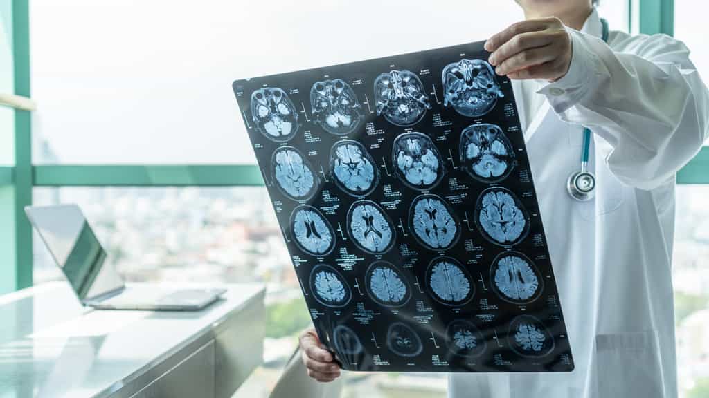 L'IRM pourrait devenir un outil d'aide au diagnostic des maladies psychiatriques. © chinnapong, Adobe Stock
