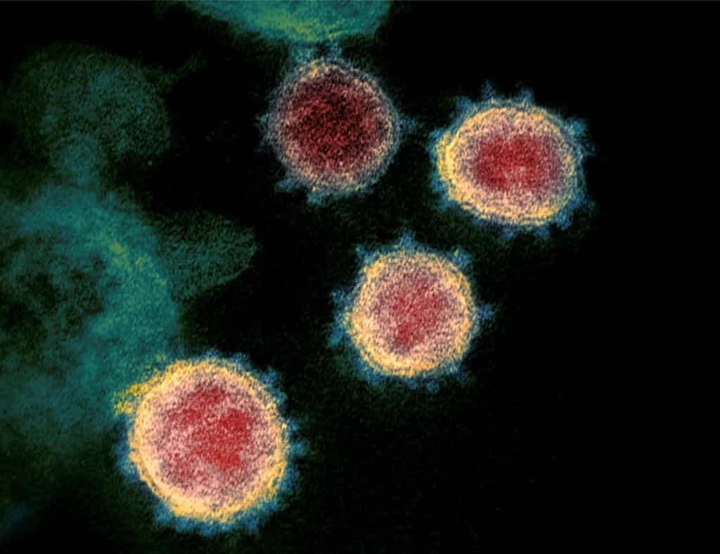 Le coronavirus SARS-CoV-2 infecte les cellules par l'intermédiaire de deux protéines cellulaires ACE2 et TMPRSS2. © Handout, National Institute of Health, AFP Archive