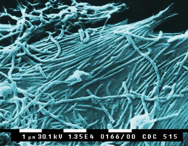 Cette image de microscopie électronique montre des virions d’Ébola. © Public Library of Science, Plos Biology 2005