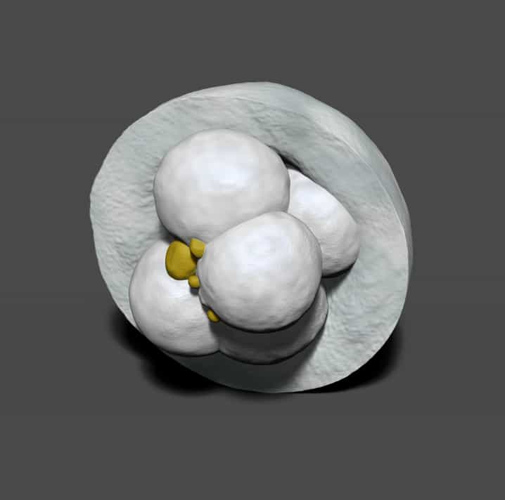 La maquette 3D d'un embryon humain âgé de trois jours et qui est la copie imprimée en 3D de son modèle vivant. On remarque quatre grosses cellules et des plus « fragmentées&nbsp;», qui pourraient gêner la nidification dans l'utérus. Avant une implantation, les médecins pourront s'en servir pour vérifier si ce candidat est le bon. © CHU Montpellier, Inserm, UM1, Tridilogy