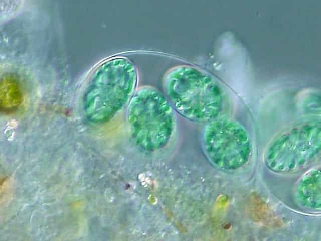 Les glaucophytes, comme ce Glaucocystis sp., peuvent mesurer 50 µm de long. © NEON jr, Wikimedia Commons, cc by sa 2.5