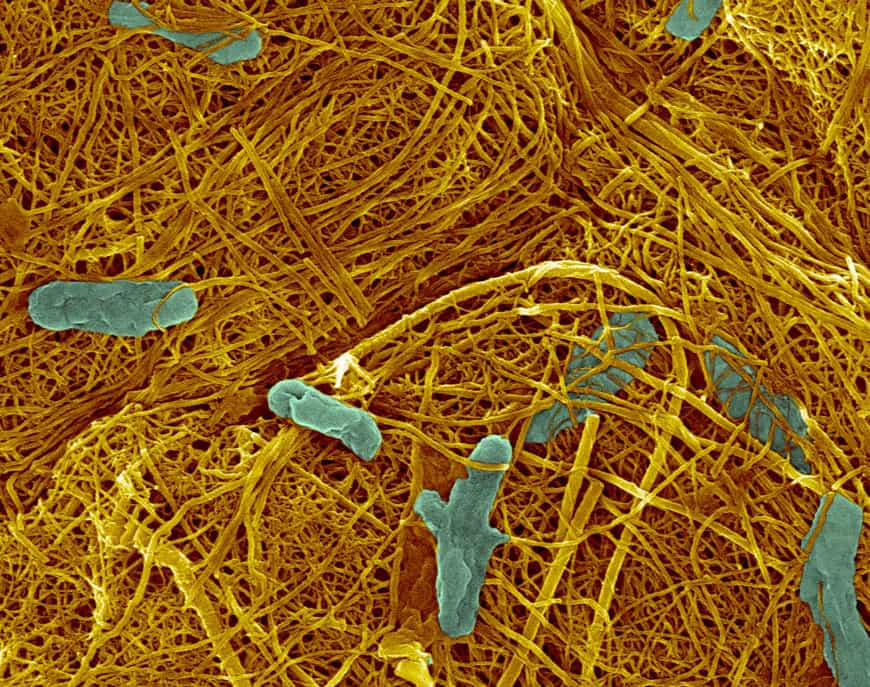 En bleu, les bactéries marines Shewanella. Crédit : Hor-Gil Hur, GIST