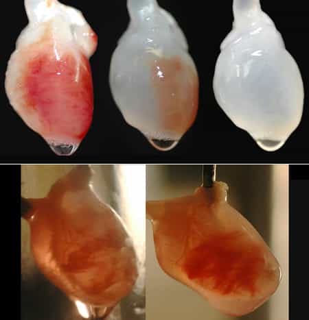 Le cœur a d'abord été débarrassé de ses cellules (images du haut) puis colonisé avec de nouvelles cellules (en bas). © Thomas Matthiesen/University of Minnesota
