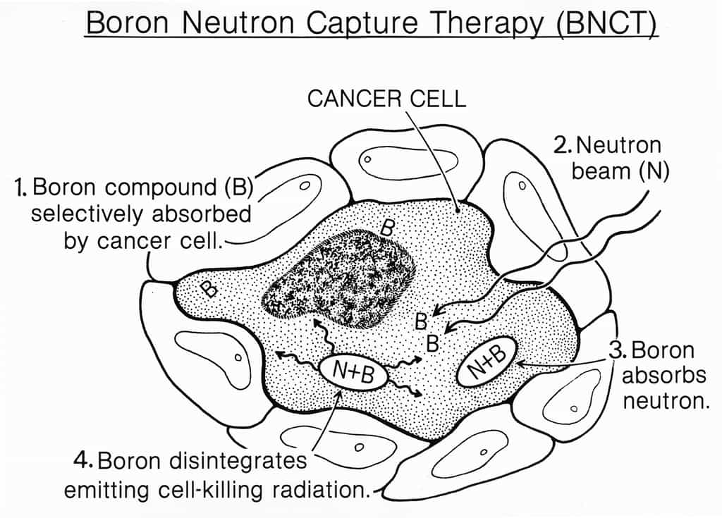 La Boron Neutron Capture Therapy (BNCT) est une méthode d’irradiation en plusieurs étapes : (1) le bore 10 est absorbé par la cellule cancéreuse, (2) le neutron entre à son tour dans la cellule, (3) le bore interagit avec le neutron pour donner du bore 11, (4) le bore 11 se désintègre et émet des radiations qui tuent la cellule. © National Cancer Institut, Wikimedia Commons, cc by sa 3.0