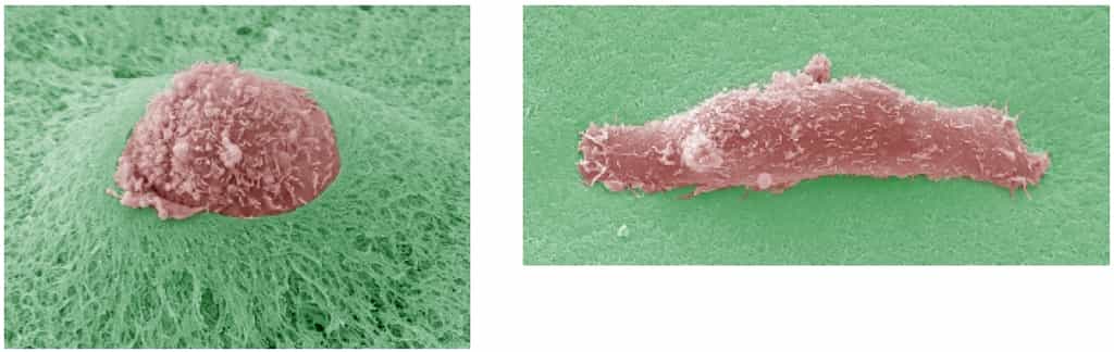 A gauche, une cellule tumorale perce une épaisseur de Matrigel, mimant la membrane basale. A droite, les protéases ont été inhibées, la cellule ne peut pas perforer la surface. © Renaud Poincloux et Philippe Chavrier/CNRS/Institut Curie