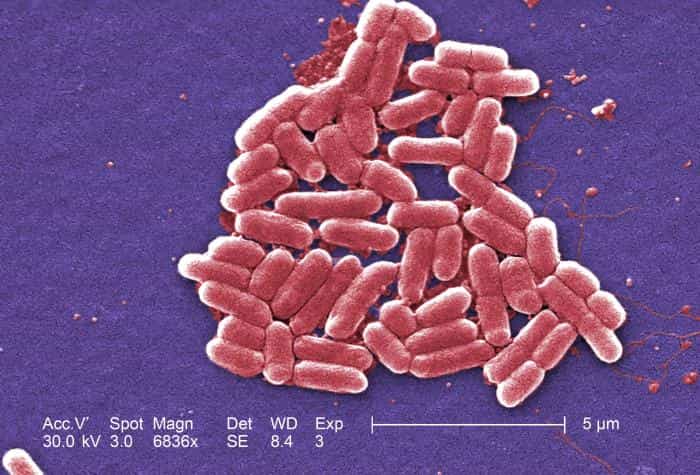 La célèbre bactérie Escherichia coli est l'une des espèces constituant notre flore intestinale. À quel point l'utilisation d'antibiotiques modifie-t-elle leurs populations dans les entrailles humaines ? © J. Carr, CDC, DP