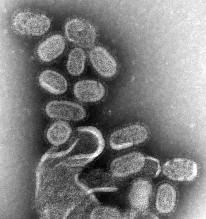 Cette image, obtenue par MET (microscope électronique en transmission) montre des virus de la grippe H1N1. Crédit : Cnrs