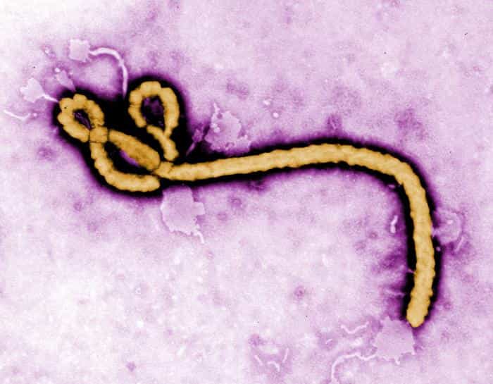 Le virus Ébola, ici à l'image, est l'un des plus mortels. Lors d'épidémies, certaines souches ont tué 90 % des personnes infectées. Pour l'heure, il n'existe encore aucun traitement. Parvenir à activer la protéine IFITM3 serait une piste... © Frederick Murphy, CDC, DP
