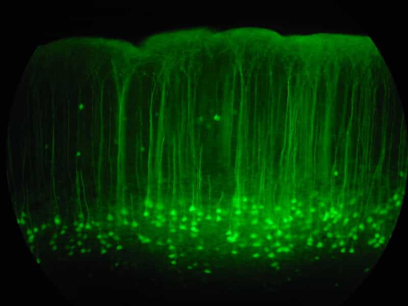 La&nbsp;GFP (green fluorescent protein) est souvent utilisée en recherche médicale. Cette image représente une coupe de cortex de souris dont les cellules ont été marquées par cette protéine fluorescente. La GFP provient de la méduse&nbsp;Aeqoria victoria.&nbsp;© Robert Cudmore, Wikimedia Commons, cc by sa 2.0