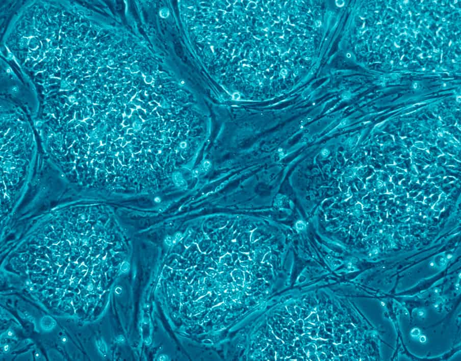 Bien que très prometteuse, l’utilisation des cellules souches pose de nombreux problèmes éthiques et politiques. En effet, ces cellules proviennent majoritairement d’embryons qui sont à un stade très précoce. Leur utilisation, pourtant extrêmement puissante, est donc difficile, car elle nécessite la destruction d’embryons. © Human_embryonic_stem_cell, Wikimedia Commons, cc by sa 3.0