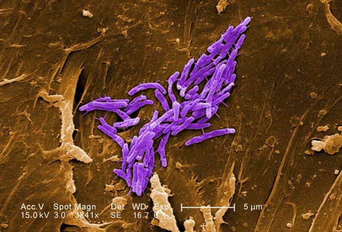 Mycobacterium tuberculosis, représentée par ces bâtonnets colorisés en violet, est la bactérie responsable de la tuberculose. On l'appelle aussi bacille de Koch, en référence à son découvreur. Selon l'OMS, en 2010, près de 9 millions de cas ont été détectés à travers le monde et 1,4 million de personnes en sont mortes. La maladie n'est donc pas anodine. © Janice Haney Carr, CDC, DP