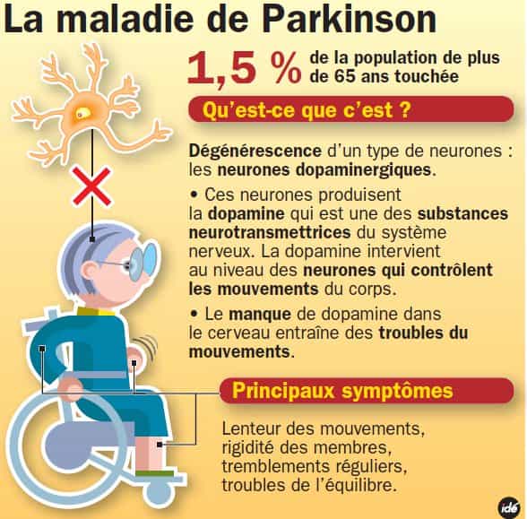 La maladie de Parkinson est la deuxième maladie neurodégénérative après la maladie d'Alzheimer. © ide