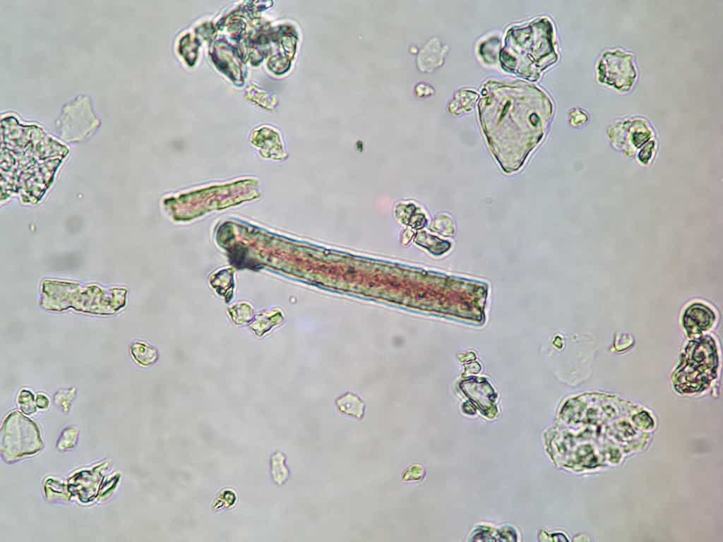 Photographie au microscope d'un phytolithe, en forme de cellule allongée. © Henri-Georges Naton, Wikipédia, GNU 1.2