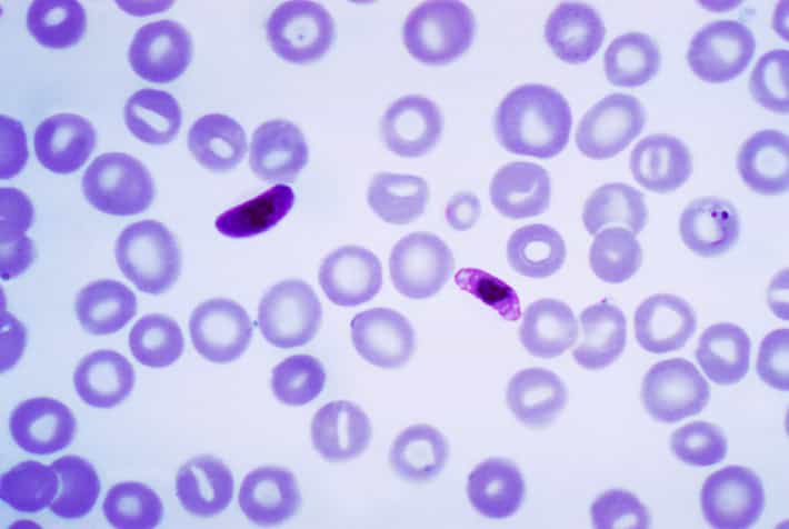 Le paludisme est une maladie infectieuse causée par des parasites du genre&nbsp;Plasmodium. L'espèce la plus dangereuse est&nbsp;Plasmodium falciparum,&nbsp;ici à l'image. Son cycle de vie en plusieurs phases rend les traitements difficiles. ELQ-300, en s'attaquant à ces différents stades, semble plus efficace que les médicaments actuels.&nbsp;© Center for&nbsp;Disease&nbsp;Control, Wikimedia Commons,&nbsp;cc by sa 3.0