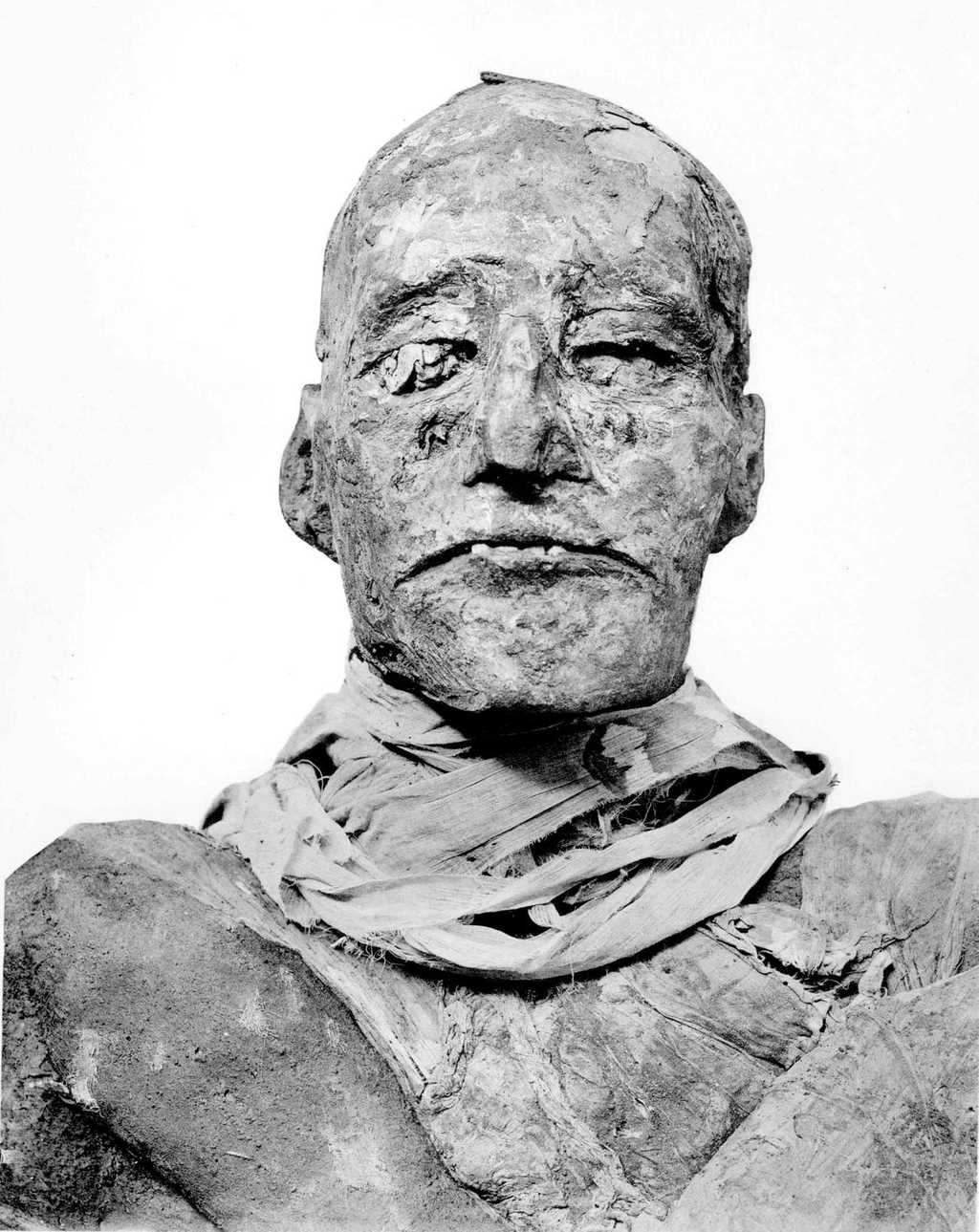 La momie de Ramsès III. Le règne de ce pharaon a duré plus de 31 ans. Il n'a cessé de lutter contre la corruption qui gangrenait son pays. © Zahi Hawass et al. 2012, British Medical Journal