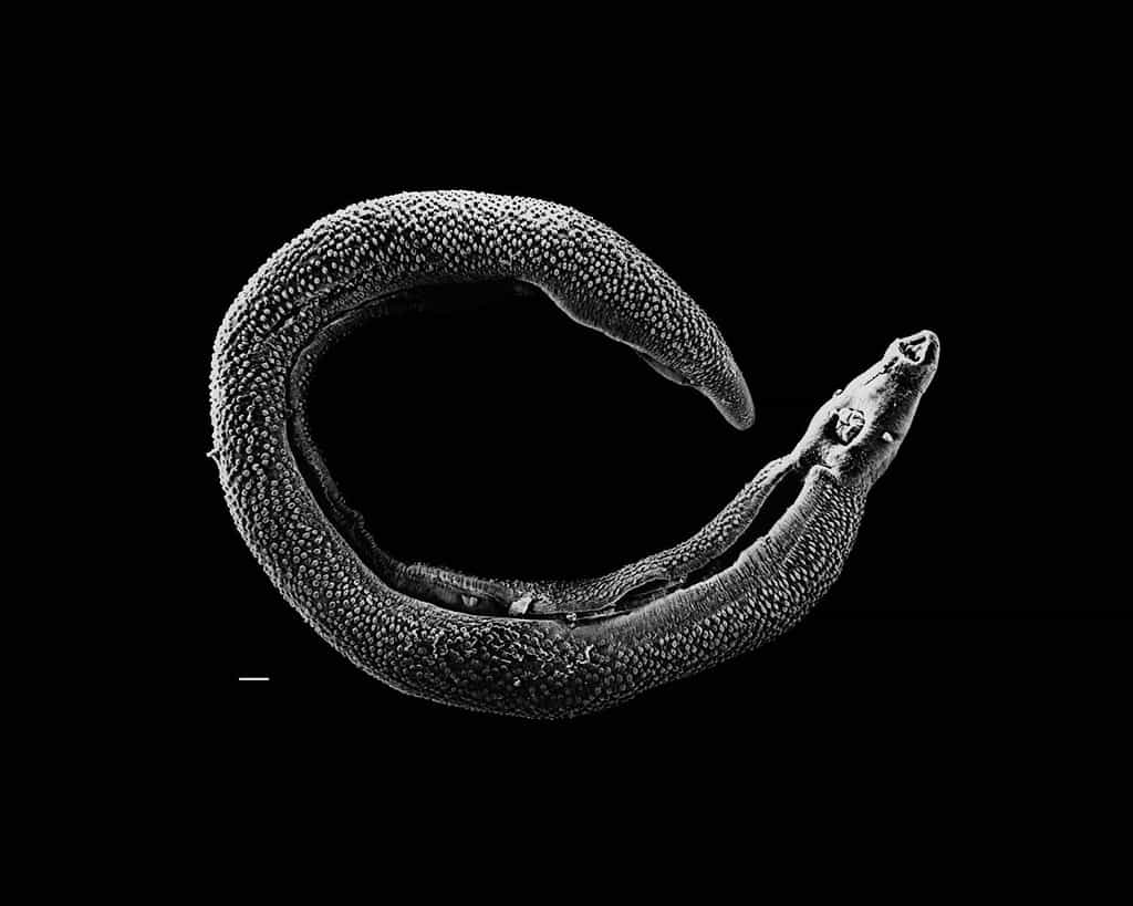 La schistosomiase, ou bilharziose, est une maladie due à l'infestation par un ver parasite nommé schistosome. © David Williams, Illinois State University, Wikipédia, DP