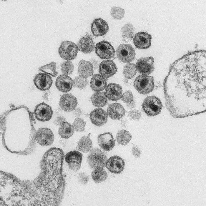 Il existe plusieurs variants du VIH. Le VIH-1 de type M est cependant ultramajoritaire, étant à l'origine de 90 % des infections. © Maureen Metcalfe, Tom Hodge, CDC, DP