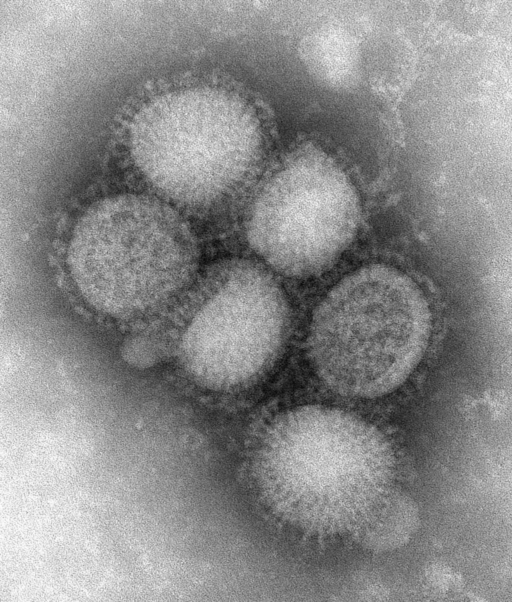 Le virus A(H1N1). Des millions de personnes l'ont rencontré et vaincu. © Centers for Disease Control and Prevention