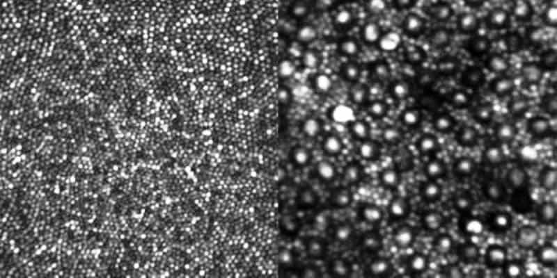 L'image de gauche montre les plus petits cônes au centre de la rétine dans la zone appelée la fovéa. Sur la droite, les formes brillantes cerclées de noir sont aussi des cônes mais on voit maintenant les bâtonnets, dix fois plus nombreux, les entourant. © University of Rochester/Biomedical Optics Express