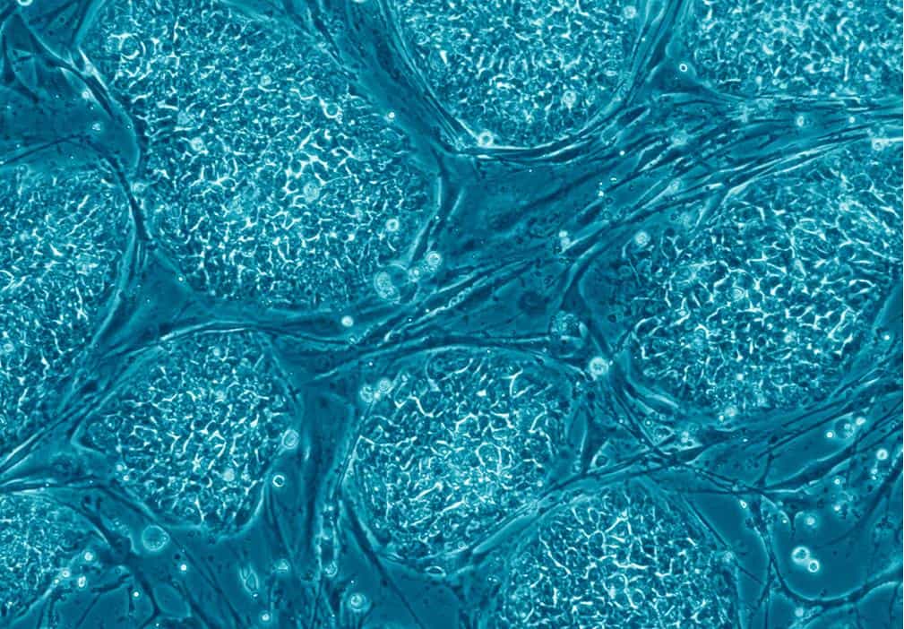 Les cellules souches possèdent le pouvoir de&nbsp;se différencier en n'importe quel tissu. Les premières qui furent découvertes, les cellules souches embryonnaires (CSE, à l’image) posaient un problème éthique car comme leur nom l'indique, elles sont prélevées sur un embryon humain, et nécessitent généralement&nbsp;sa destruction. En 2007, des chercheurs japonais sont parvenus à redonner leur état natif&nbsp;à des cellules déjà différenciées : ce sont les cellules souches pluripotentes induites. Ainsi, on pensait éviter les limites éthiques liées aux CSE. Encore faut-il&nbsp;qu'elles soient aussi sûres pour la santé humaine...&nbsp;© Eugene Russo,&nbsp;Plos One, cc by 2.5