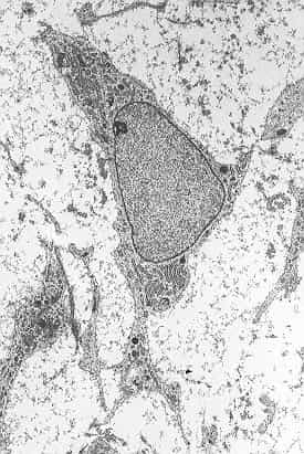 Les cellules souches mésenchymateuses (comme cette cellule à l'image dans sa morphologie typique, vue au microscope) avaient déjà été retrouvées dans certains organes, mais on ignorait leur présence dans le cerveau. Reste maintenant à définir leur utilité et leurs limites dans les thérapies cellulaires visant à réparer des régions cérébrales lésées. © Robert M. Hunt, Wikipédia, cc by 3.0