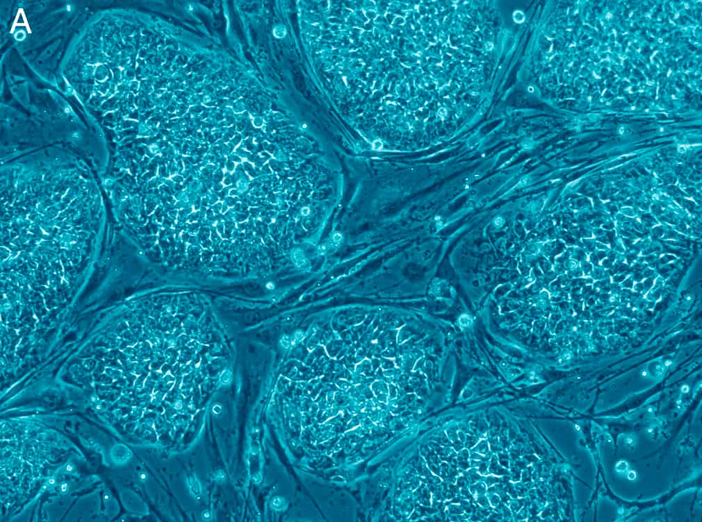 Les cellules souches embryonnaires ont été découvertes en 1981 chez la souris et en 1998 chez l'Homme. Leur utilisation pose de nombreux problèmes éthiques. © Eugene Russo,&nbsp;Plos One