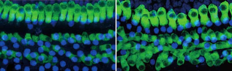 Chez les souris devenues sourdes à cause d'une exposition sonore trop intense (à gauche), un traitement à base d'un médicament inhibiteur de la gamma-sécrétase (à droite) permet de régénérer des cellules ciliées (en vert) qui avaient disparu. © Mizutari et al., Neuron