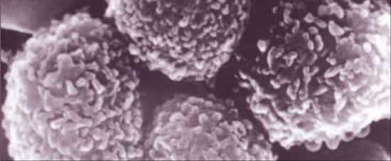 Ce 4 février, c'est la Journée mondiale contre le cancer. L'occasion de faire le point sur la maladie qui reste la première cause de mortalité en France et la deuxième dans le monde. Les thérapies progressent, et désormais on propose d'utiliser un scanner pour éviter les risques de récidive. © DR