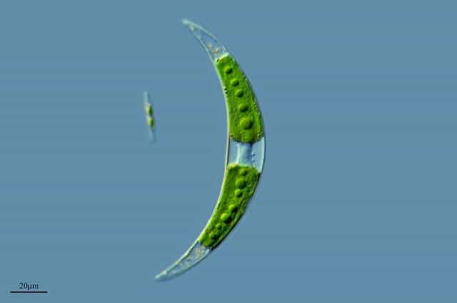 L'algue Closterium moniliferum prend une forme en croissant de lune. © Proyecto Agua/Water project, Flickr, CC by-nc-sa 2.0