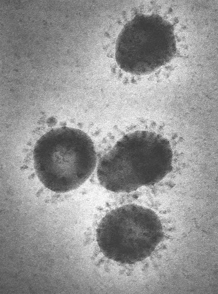 Avant même l'épidémie meurtrière de Sras qui s'est déroulée en Asie entre 2002 et 2003, les scientifiques avaient prédit l'émergence d'un coronavirus mortel, de par la propension que ce genre de virus a à muter. © Fred Murphy et Sylvia Whitfield, CDC, DP