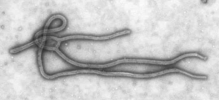 Le virus Ebola (ici vu au microscope électronique) possède une forme filamenteuse, d'où son appartenance à la famille des Filoviridés. Crédits DR